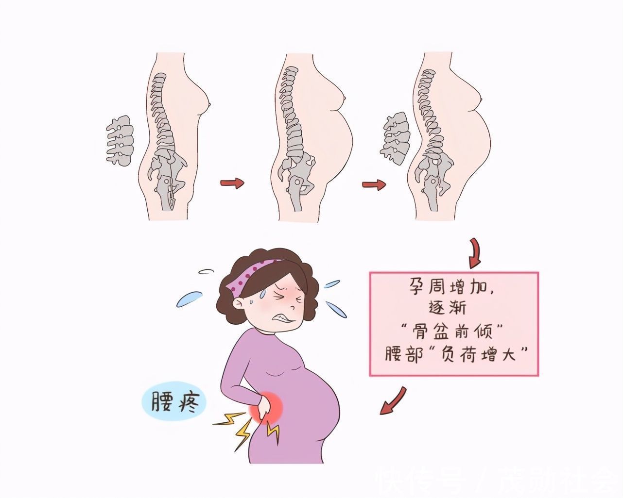 孕期|孕期里,除了肚子,这四个部位也要“重点保护”,孕妈别大意