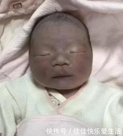 自然也就会|“黑脸宝宝”火了,出生后被家人嫌弃丑,2个月后逆袭成团宠