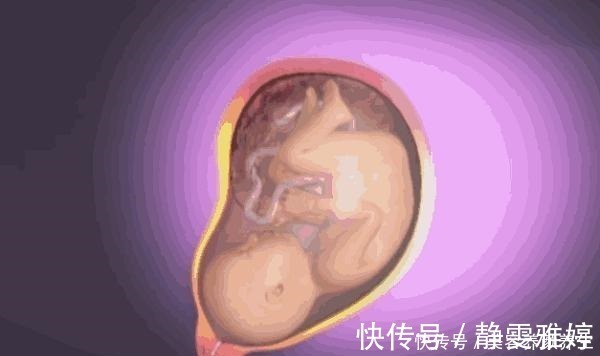 身体不适|宝宝出生后,产妇身体会发生什么变化看完忍不住心疼!