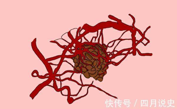 一日三餐|不易患癌的人，身体上一般都有几个特点，对比一下自己是否都有