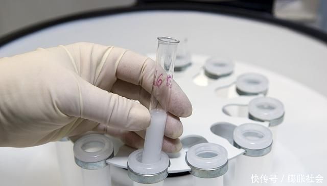 精子|试管婴儿和自然怀孕孩子,最大区别可能不是寿命长短,而是这点
