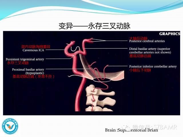 mr|椎-基底动脉系统解剖