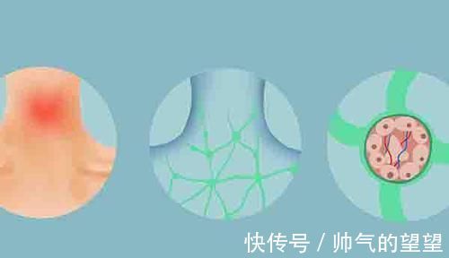 繁殖|癌症患者做完手术,已经把肿瘤切干净了,为何之后却还是复发了