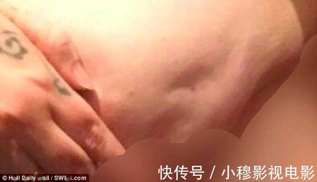 肝癌|身上出现4个小变化,当心肝癌、乳腺癌盯上你!洗澡时看一眼、摸一下能救命