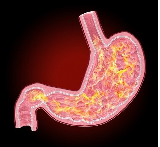 区别|胃炎和胃癌最明显区别有哪些医生教你2点来辨别