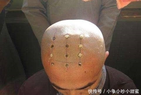 戒疤|古代和尚为什么要烧几个戒疤?是为了区分还是因为虔诚?
