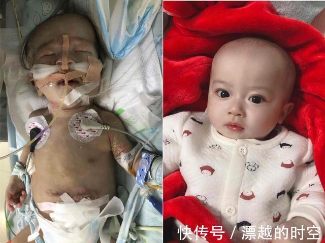 邱娟|泪目!女子求助无门欲拔掉娃的氧气时,孩子突然伸手给她擦眼泪