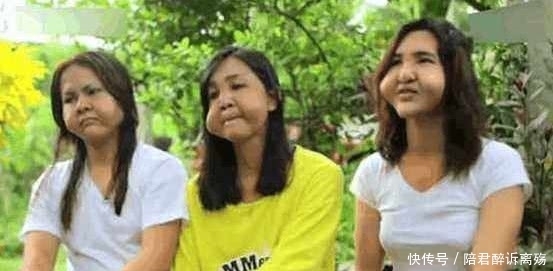 整容手术|三姐妹做整容手术只花100元，结果令她们后悔不已