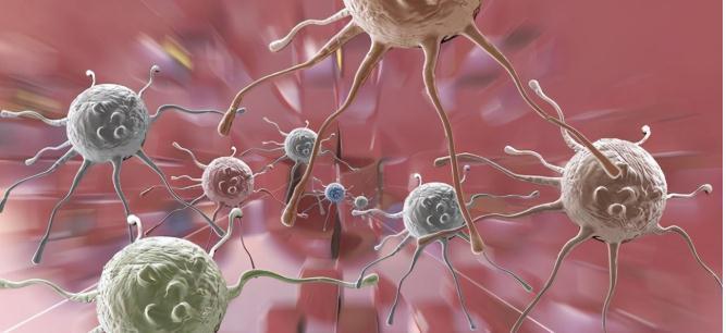 肠上皮化生|尽量做到以下这四点,远离癌症