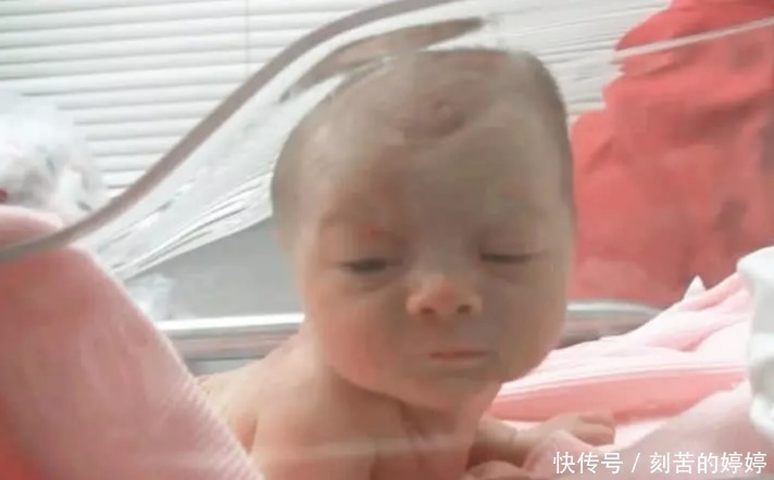 医生|刚出生两天的婴儿听到妈妈的声音,居然抬头看妈妈,医生都看愣了