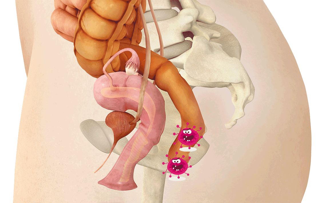 尿路感染|私处清理的奇葩方法——冷热酸甜辣碱咸