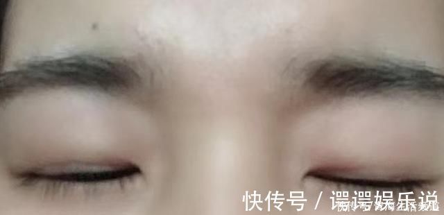 行政部门|姑娘花10000多割双眼皮,曝出前后对比照,网友直言勇气可嘉!