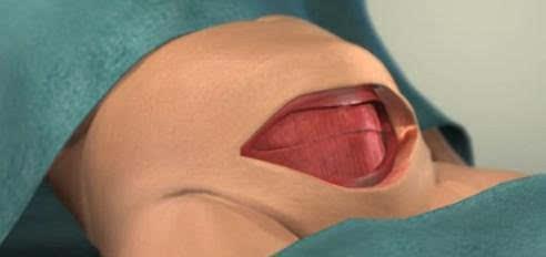 妈妈|剖腹产手术全过程!只有躺在产床上的妈妈,才知道那种滋味