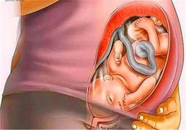 骨盆|孕晚期,胎宝宝头朝下晕眩难受吗为了见妈妈,胎儿其实很努力