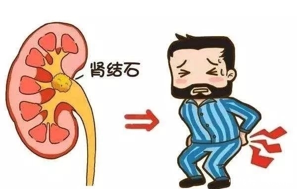 听朋友说是肾不好所以才会腰疼，这是真的吗？