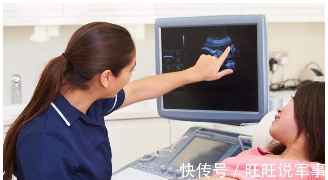 发育|产检一共要做几次大排畸检查?分别是在什么时间?一次讲清楚!