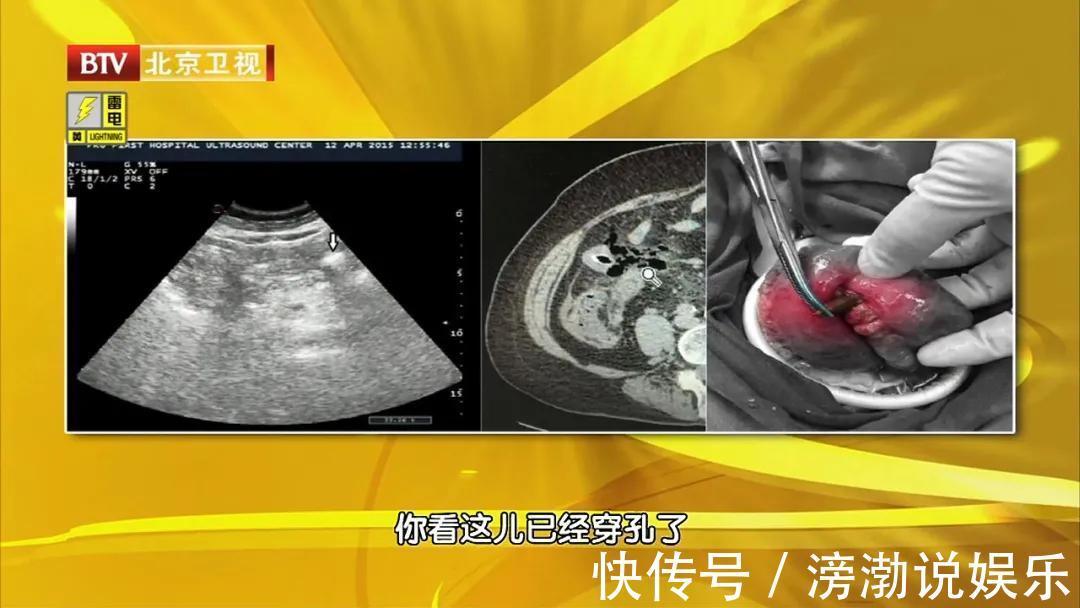 气血|大枣这样吃,功效翻几倍!每天吃3颗,气血足,脾胃好