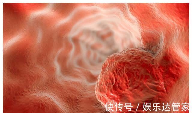 肺部|想要筛查癌症,要做哪些项目?总结这5个,建议体检时加上