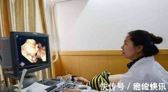 雯雯|四维彩超太难通过过来人提前做好这3件事,免得折腾太久