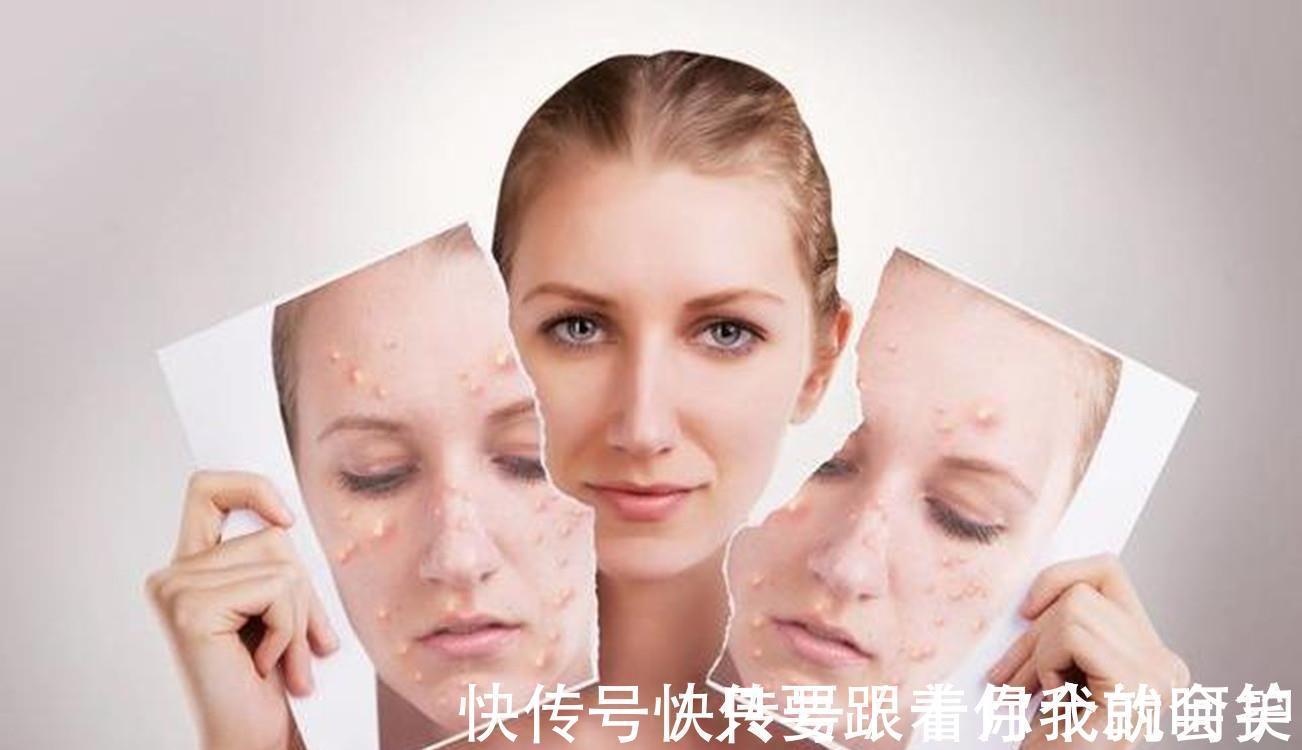 皮肤 皮肤老爱出油?这几个护肤知识要知道,避免形成“大油田”