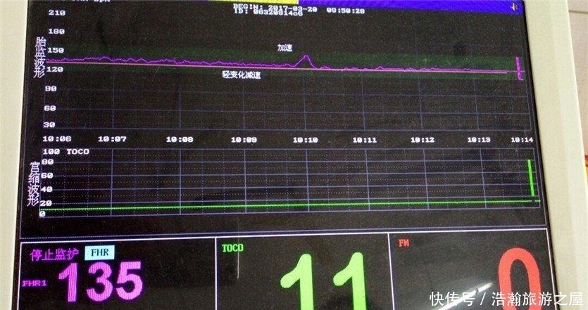 宝妈|孕28周后建议每两周做一次孕检,不是胎儿发育不好,是他太嗨!