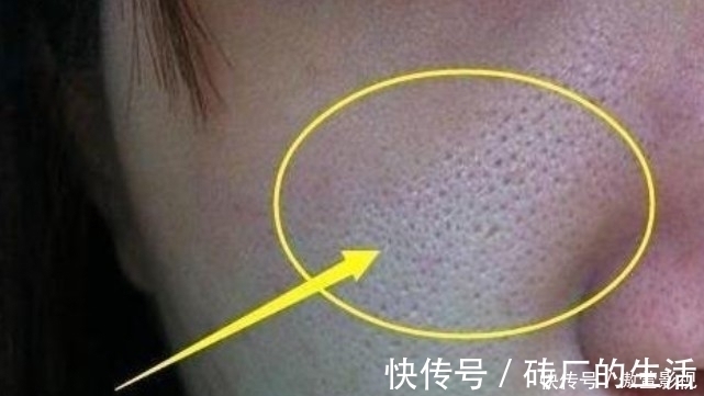 防晒 好皮肤是养出来的,记住这个护肤小技巧,不怕没有好皮肤