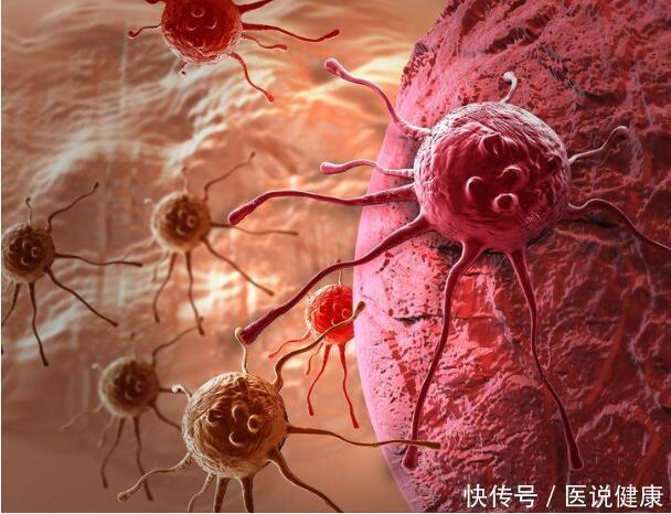 癌细胞|熬过意味着活着对于癌症患者而言，为何5年是一道生死坎