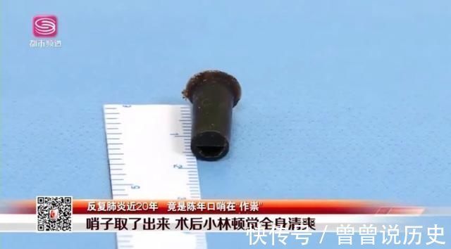 孩子|6岁男孩吞哨子怕被骂瞒了20年:当孩子犯错,你的第一句话很重要