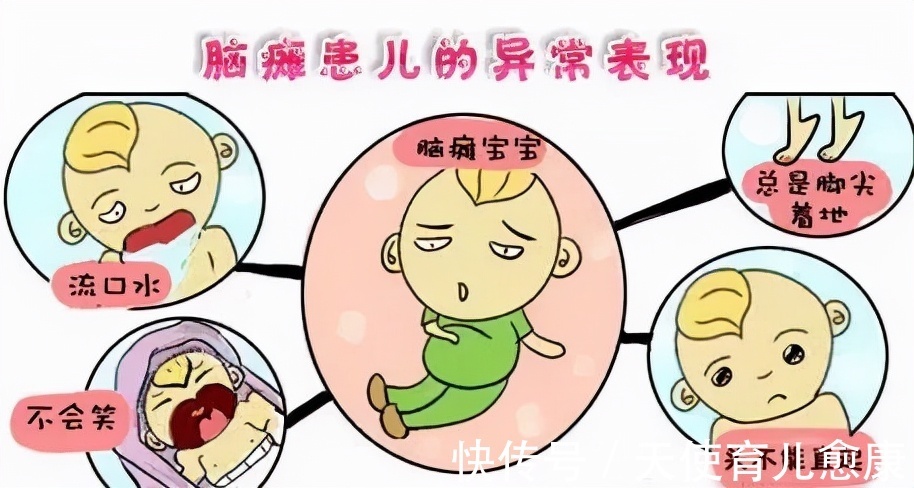临床表现|天使科普:小儿脑瘫的早期临床表现有哪些?