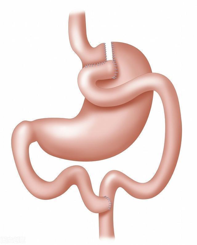 消化液|最不易被发现的癌症“胰腺癌”,长期有这四种异常必须注意