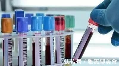 患者|肌酐多高才说明肾功能问题严重了呢？不少人对肾衰竭理解错了