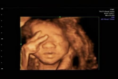 宝宝|被宝宝的四维彩超照丑哭了？不是医生技术不好，而是有客观原因的