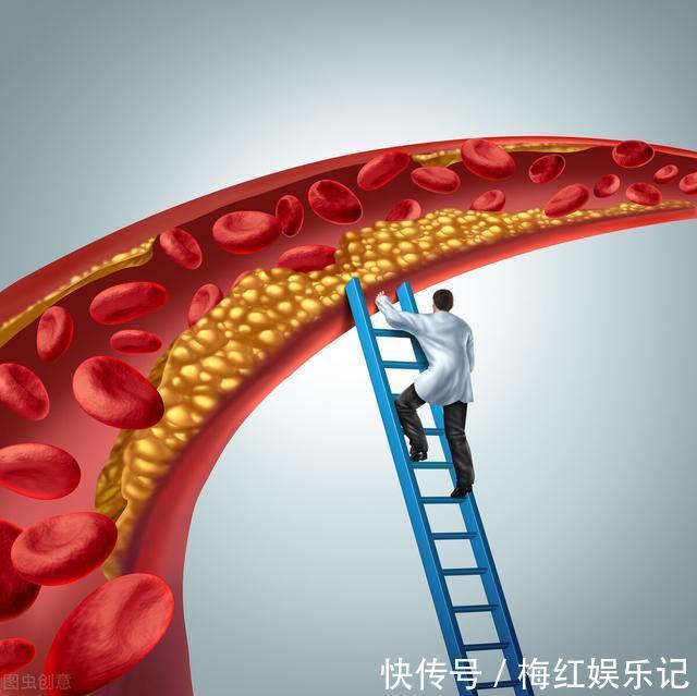 血脂|高血脂每天吃一个鸡蛋可以吗?蛋黄还能吃吗?辟谣来了