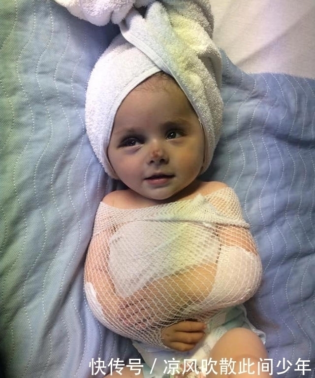 父母|七岁小女孩刚出生多灾多难,母亲坚持生下她,每天忍受骨折之痛
