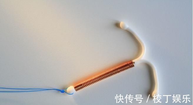 节育环|除了安全套,4种常用的避孕方法,你应该知道!安全又靠谱