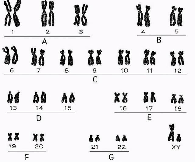 扭伤|已婚女子意外扭伤被查出是“男性”,医生:可以自行选择人生方向