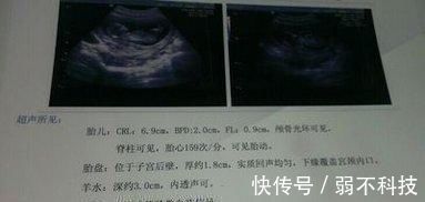 特征|孕检单上若有这3个“特征”,恭喜,或许是“小王子”要来了