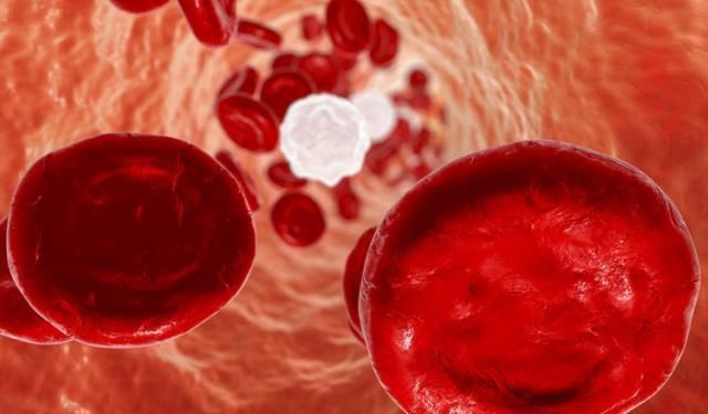 木耳|不是洋葱和木耳,“溶栓高手”是它,每天泡水喝,血栓悄悄不见了