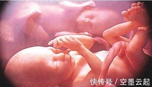 婆婆|孕妇顺产双胞胎后大喊:肚子还在动,医生检查发现惊喜