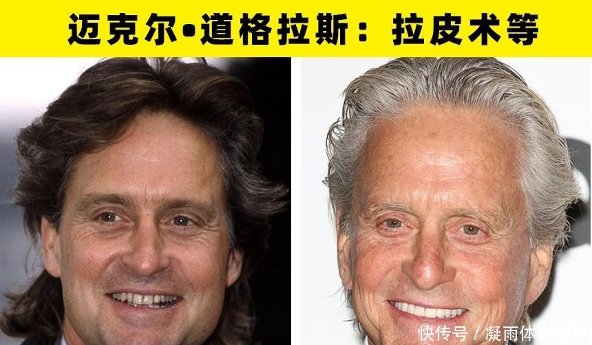 乔治·克鲁尼|大方承认自己做过整形手术的8名好莱坞明星