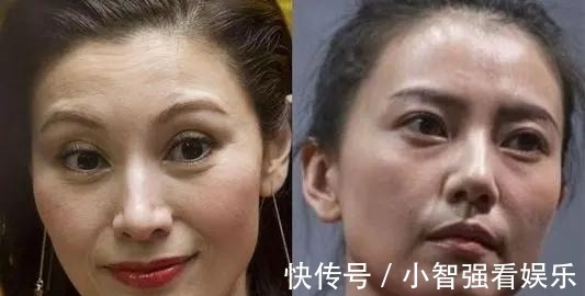 衰老|女性开始衰老的时候,脸部或有这几个表现,快来了解一下吧