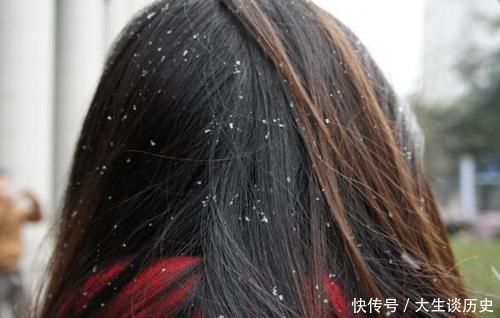 日常生活中|满头都是头皮屑,总是洗不干净?可能是身体出了问题,别忽视!