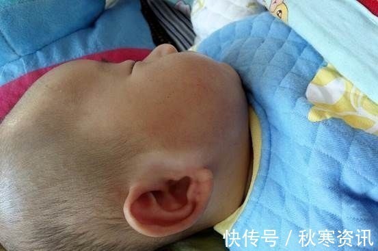 卤门|宝宝的5大部位,家长摸不得,要摸就摸这3个部位,越摸越聪明