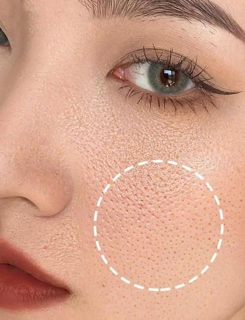 肤色|长期化妆有什么危害?看“妆龄”10年的皮肤有啥问题,尤其第二个