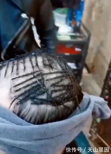 脱发|奇闻:男子秃头了还烫发,看到效果,网友:大叔变小鲜肉