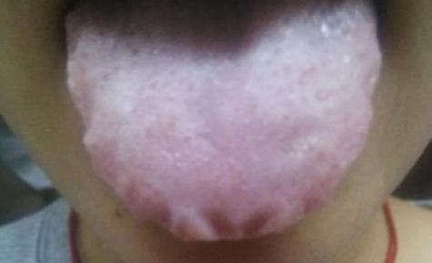 症状|“嘴里”出现4种症状,医生赶快去检查,心脏“病”到晚期