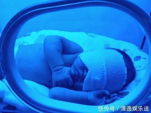 黄疸|宝宝出生后没黄疸,八成是孕妈在孕期做了3件事,对大人孩子都好