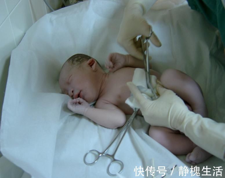脚心|新生儿宝宝哇哇哭,是因为剪脐带痛吗?医生弹了下宝宝脚心笑了