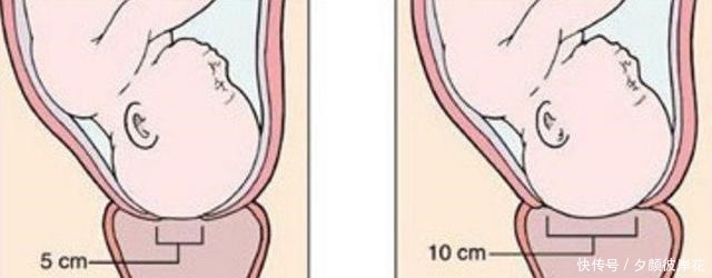 女人生产前所说的宫口开十指，你还以为是十个手指头吗