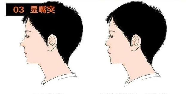 美者 鼻基底对面部影响有多大鼻基底凹陷如何改善_芯动医美课堂!